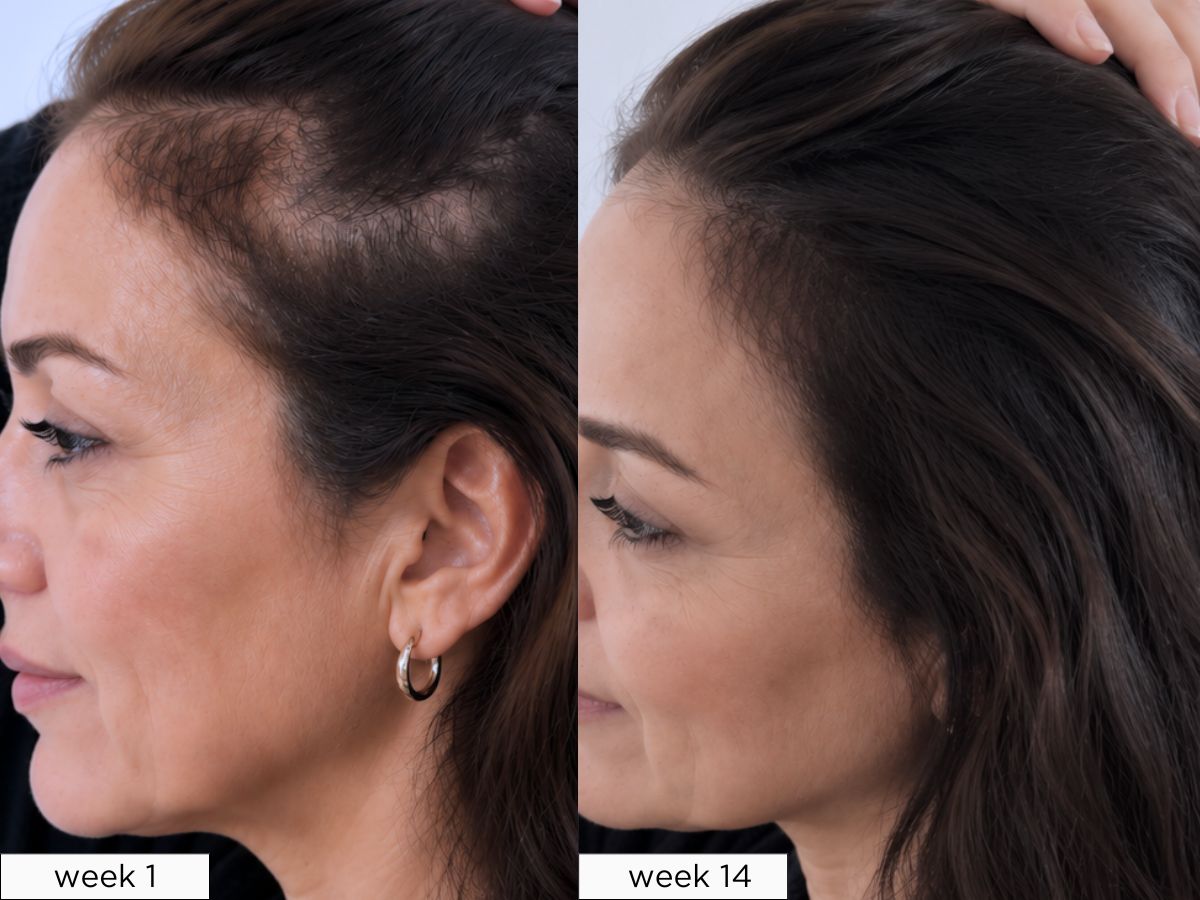 Maria, age 48 — before and after